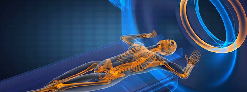 Imaging - Magnetic Resonance Imaging (MRI) Top Image Imaging - Magnetic Resonance Imaging (MRI) Top Image